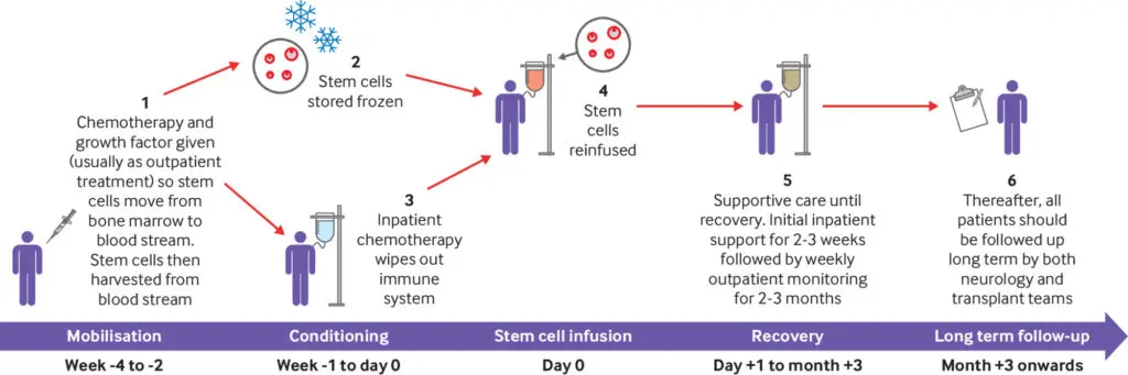 O reprezentare a unei proceduri de transplant de celule stem într-un cadru clinic