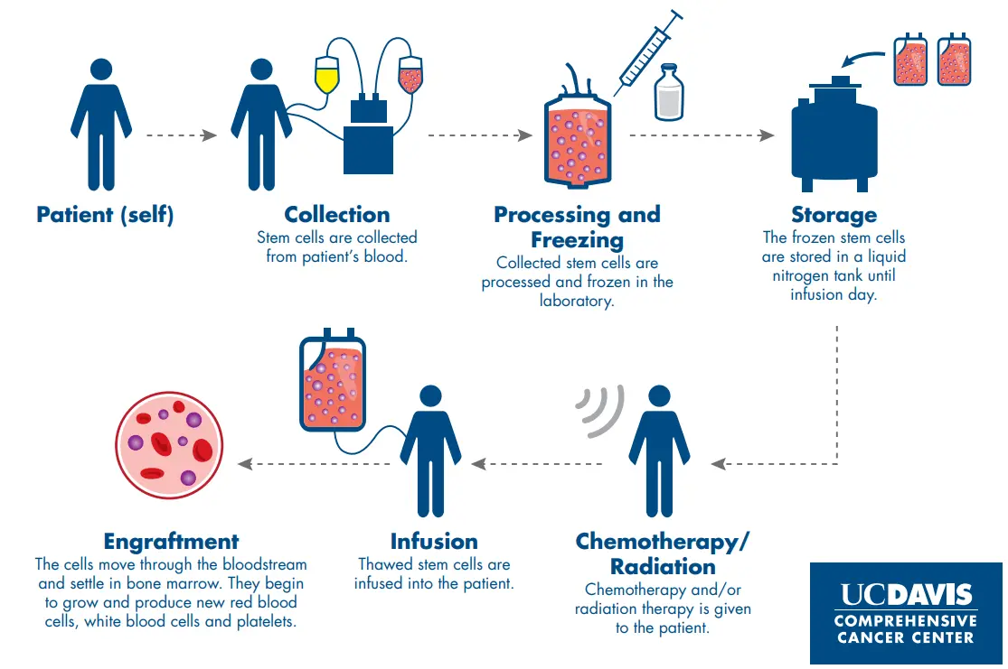 Diagramă a fluxului de lucru de la colectarea celulelor până la injectare