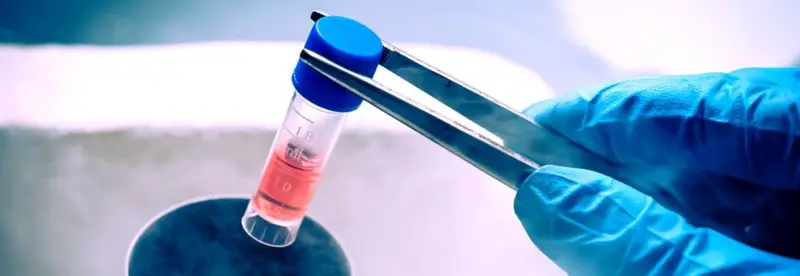 Terapia cu celule stem pentru boala Crohn aprobată în Europa