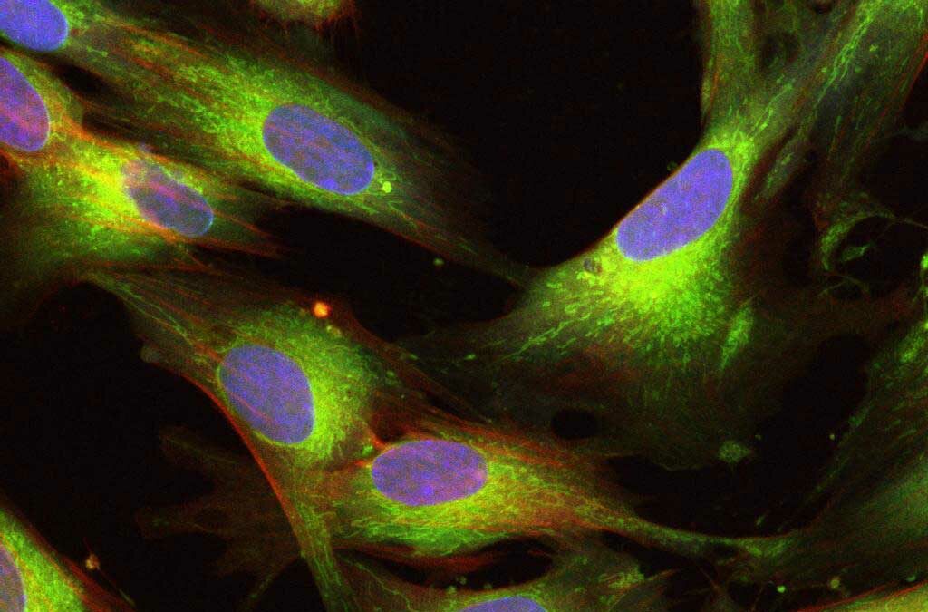 Celule stem UCMSC